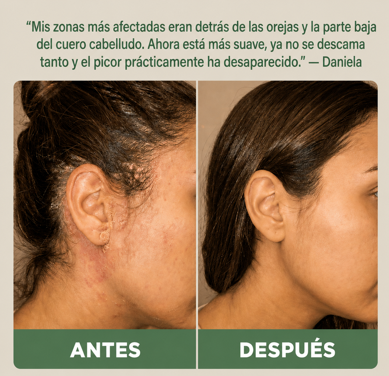 Exfoliante Capilar Natural Dermavia